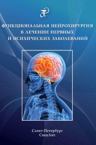 Функциональная нейрохирургия в лечении нервных и психических заболеваний
