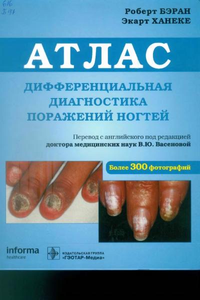 Атлас. Дифференциальная диагностика поражений ногтей