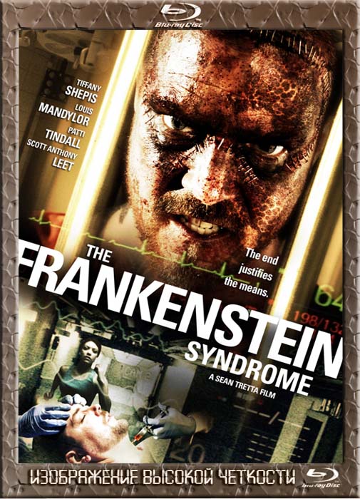 Синдром Франкенштейна